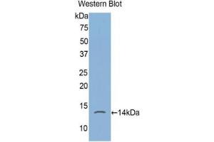 Detection of recombinant FKBP1A using Polyclonal Antibody to FK506 Binding Protein 1A (FKBP1A) (FKBP1A 抗体  (AA 2-108))