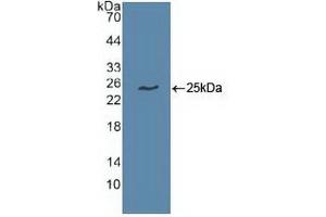 Detection of Recombinant UBE2C, Human using Polyclonal Antibody to Ubiquitin Conjugating Enzyme E2C (UBE2C) (UBE2C 抗体  (AA 2-179))