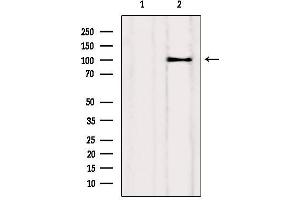 Western blot analysis of extracts from Myeloma cells, using Drebrin Antibody. (DBN1 抗体  (Internal Region))