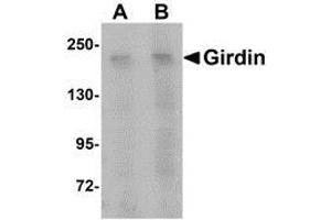 Western blot analysis of Girdin in rat brain tissue lysate with AP30364PU-N Girdin antibody at (A) 1 and (B) 2 μg/ml. (Girdin 抗体  (C-Term))