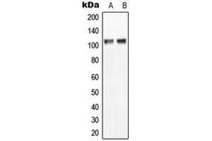 Western blot analysis of NGEP expression in MCF7 (A), NIH3T3 (B) whole cell lysates. (Anoctamin 7 抗体  (C-Term))