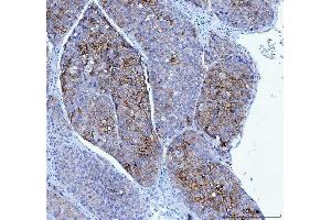 IHC analysis of Poliovirus Receptor/PVR using anti-Poliovirus Receptor/PVR antibody (ABIN7601070).