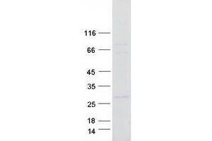Western Blotting (WB) image for Tetratricopeptide Repeat Domain 9C (TTC9C) protein (Myc-DYKDDDDK Tag) (ABIN2734497)