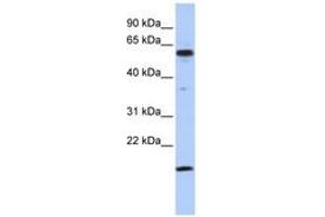Image no. 1 for anti-Thyroid Hormone Receptor Interactor 10 (TRIP10) (C-Term) antibody (ABIN6742770) (TRIP10 抗体  (C-Term))