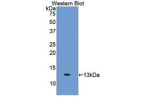 Western Blotting (WB) image for anti-Interleukin 6 Receptor (IL6R) (AA 385-462) antibody (ABIN3206018) (IL-6 Receptor 抗体  (AA 385-462))
