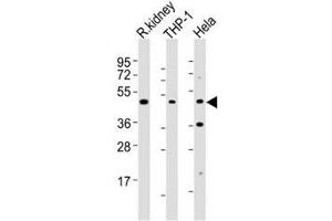 Western blot testing of BMP2 antibody at 1:2000 dilution. (BMP2 抗体)