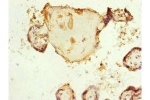Immunohistochemistry of paraffin-embedded human placenta tissue using ABIN7151154 at dilution of 1:100 (RNF139 抗体  (AA 510-664))
