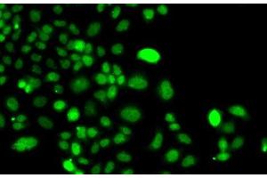 Immunofluorescence (IF) image for anti-Phosphatidylinositol-5-Phosphate 4-Kinase, Type II, alpha (PIP4K2A) antibody (ABIN7263459)