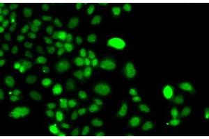 Immunofluorescence analysis of A549 cells using PIP4K2A Polyclonal Antibody (PIP4K2A 抗体)