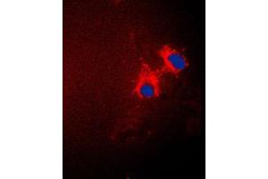 Immunofluorescent analysis of p15 INK4b staining in A549 cells. (CDKN2B 抗体  (C-Term))