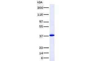 Validation with Western Blot (VEGFA Protein (Transcript Variant 1))