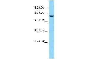WB Suggested Anti-Jakmip1 Antibody   Titration: 1. (JAKMIP1 抗体  (N-Term))