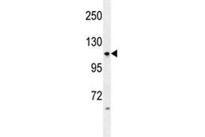 Anti-LGR5 antibody western blot analysis in HL-60 lysate (LGR5 抗体  (AA 605-638))