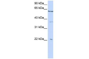 WB Suggested Anti-CSRP2 Antibody Titration:  0. (CSRP2 抗体  (C-Term))