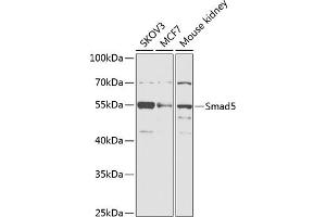 Western blot analysis of extracts of various cell lines, using Smad5 antibody (ABIN6128714, ABIN6148090, ABIN6148091 and ABIN6218232) at 1:1000 dilution.