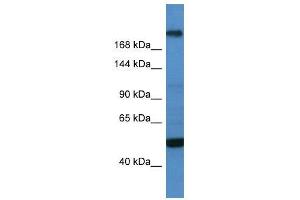 WB Suggested Anti-TCF20  Antibody Titration: 0.