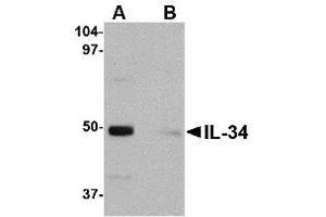 Image no. 1 for anti-Interleukin 34 (IL34) (Internal Region) antibody (ABIN342710) (IL-34 抗体  (Internal Region))