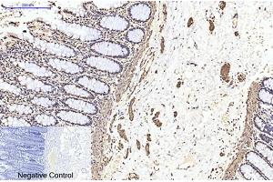 Immunohistochemical analysis of paraffin-embedded human colon tissue. (TUBB2A 抗体)