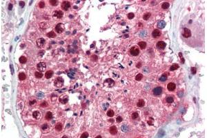 Immunohistochemistry (Paraffin-embedded Sections) (IHC (p)) image for anti-Paired Box 7 (PAX7) (AA 167-216) antibody (ABIN462176)