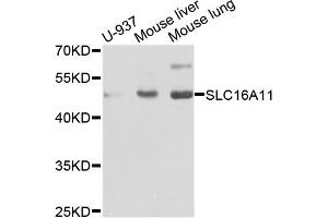 Western blot analysis of extracts of various cell lines, using SLC16A11 antibody. (SLC16A11 抗体)
