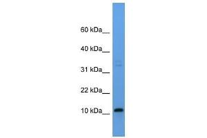 Western Blot showing Cyyr1 antibody used at a concentration of 1-2 ug/ml to detect its target protein. (CYYR1 抗体  (Middle Region))