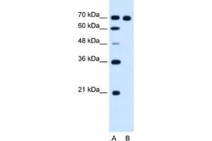 Western Blotting (WB) image for anti-Ribonucleotide Reductase M1 (RRM1) antibody (ABIN2462919) (RRM1 抗体)