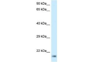 Western Blot showing RPL23A antibody used at a concentration of 1 ug/ml against Jurkat Cell Lysate