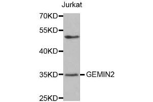 Western blot analysis of extracts of Jurkat cells, using GEMIN2 antibody. (SIP1 抗体)