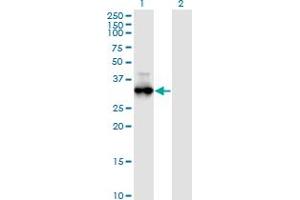 Western Blot analysis of PRKG1 expression in transfected 293T cell line by PRKG1 monoclonal antibody (M01), clone 5E5. (PRKG1 抗体  (AA 73-170))