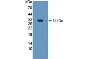 Western blot analysis of recombinant Cow HABP1. (C1QBP 抗体  (AA 71-278))