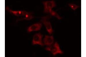 ABIN6275808 staining Hela cells by IF/ICC. (CYP4V2 抗体  (Internal Region))