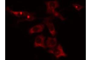 Immunofluorescence (fixed cells) (IF/ICC) image for anti-Cytochrome P450, Family 4, Subfamily V, Polypeptide 2 (CYP4V2) (Internal Region) antibody (ABIN6258485)
