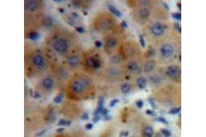 Used in DAB staining on fromalin fixed paraffin-embedded Liver tissue (HYAL2 抗体  (AA 23-447))