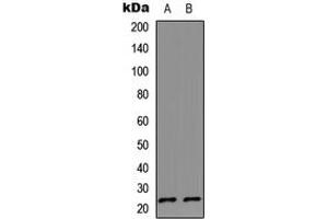 Western blot analysis of IL-17D expression in HeLa (A), Jurkat (B) whole cell lysates. (IL17D 抗体  (C-Term))