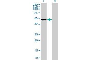 Western Blot analysis of WDR41 expression in transfected 293T cell line by WDR41 MaxPab polyclonal antibody. (WDR41 抗体  (AA 1-459))
