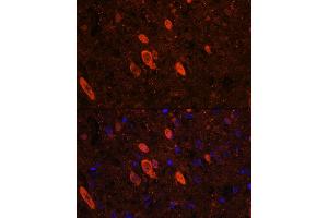 Immunofluorescence (IF) image for anti-ELAV-Like 3 (ELAVL3) (AA 1-100) antibody (ABIN6140118)