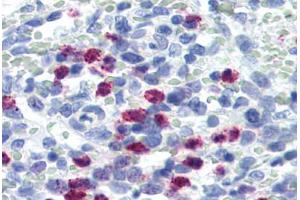 Human Spleen (formalin-fixed, paraffin-embedded) stained with FBXW7 antibody ABIN364303 at 5 ug/ml followed by biotinylated goat anti-rabbit IgG secondary antibody ABIN481713, alkaline phosphatase-streptavidin and chromogen. (FBXW7 抗体  (Internal Region))