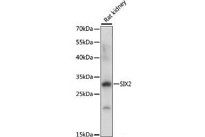 Western blot analysis of extracts of Rat kidney using SIX2 Polyclonal Antibody at dilution of 1:1000. (SIX2 抗体)