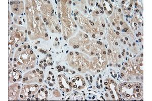 Immunohistochemical staining of paraffin-embedded Kidney tissue using anti-MAP2K4mouse monoclonal antibody. (MAP2K4 抗体)
