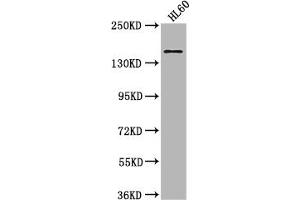 Western Blot Positive WB detected in: HL60 whole cell lysate All lanes: SMARCC2 antibody at 1:2000 Secondary Goat polyclonal to rabbit IgG at 1/50000 dilution Predicted band size: 133, 125, 127 kDa Observed band size: 170 kDa (SMARCC2 抗体  (AA 300-650))