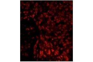 Immunofluorescence (IF) image for anti-SRY (Sex Determining Region Y)-Box 2 (SOX2) antibody (ABIN356387) (SOX2 抗体)