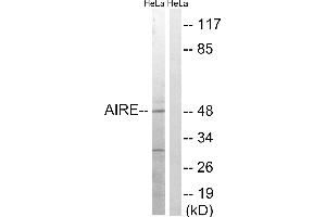 Western blot analysis of extracts from HeLa cells, treated with Hu (2nM, 24hours), using AIRE (Ab-156) antibody. (AIRE 抗体  (Ser156))