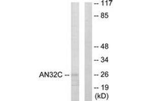 Western blot analysis of extracts from HuvEc cells, using ANP32C Antibody. (ANP32C 抗体  (AA 121-170))