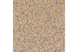 IHC analysis of Citrin/SLC25A13 using anti-Citrin/SLC25A13 antibody (ABIN7599512). (slc25a13 抗体  (AA 1-643))