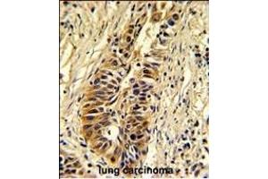 Immunohistochemistry (Paraffin-embedded Sections) (IHC (p)) image for anti-Transaldolase 1 (TALDO1) (AA 186-215) antibody (ABIN390629)