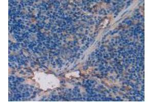 IHC-P analysis of Mouse Spleen Tissue, with DAB staining. (Thrombomodulin 抗体  (AA 31-167))