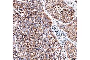 IHC analysis of EML4 using anti-EML4 antibody (ABIN6719384).