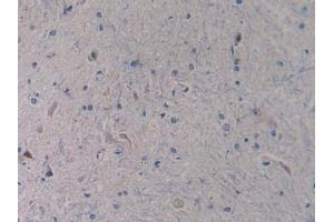 Detection of TLR4 in Rat Spinal cord Tissue using Polyclonal Antibody to Toll Like Receptor 4 (TLR4) (TLR4 抗体  (AA 49-247))