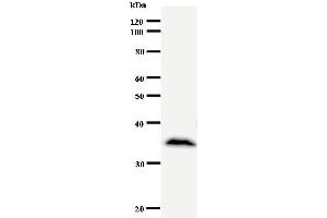 Western Blotting (WB) image for anti-Core-binding Factor, Runt Domain, alpha Subunit 2, Translocated To, 2 (CBFA2T2) antibody (ABIN930909) (CBFA2T2 抗体)