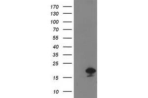 Western Blotting (WB) image for anti-Destrin (Actin Depolymerizing Factor) (DSTN) antibody (ABIN1497908) (Destrin 抗体)